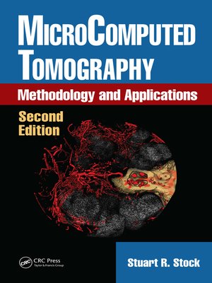 cover image of MicroComputed Tomography